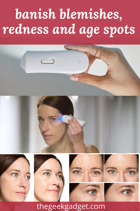 Beauty Device for Age Spot Removal & Facial Toning